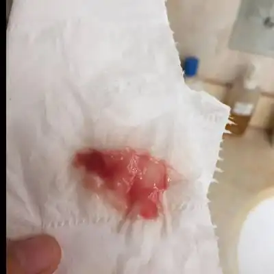 见红,但肚子不痛,没有穿羊水,表示要生吗?