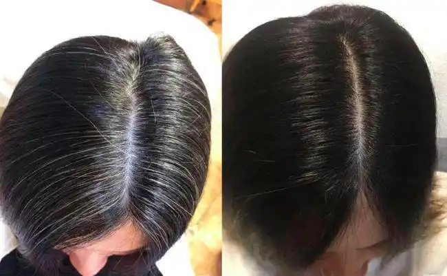 一撮白发显老5岁在家用它梳一梳30分钟变黑还你一头健康乌亮发