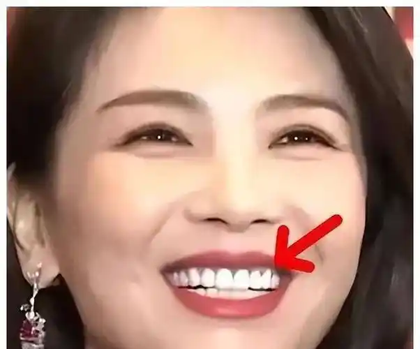 刘涛烤瓷牙后遗症曝光,揭开明星们假牙的真相!_牙齿_影响_剧中