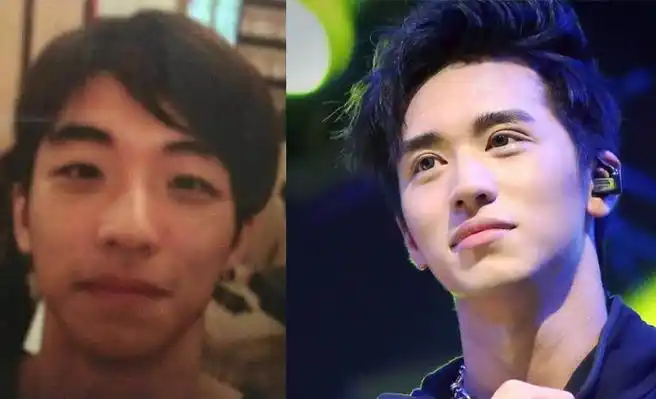 许魏洲整容前照片曝光 旧照惨不忍睹屌丝气息扑面而来