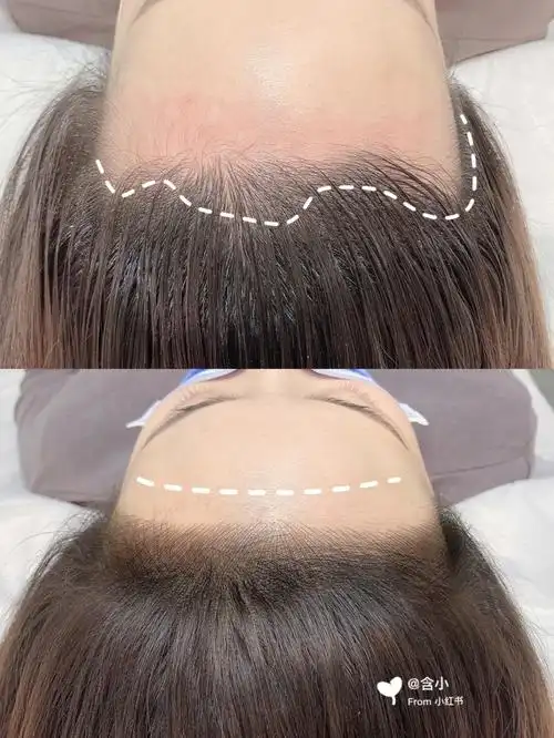 发际线纹绣绝美