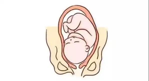 孕晚期做b超,3个数据告诉你能否顺产----民馨医院