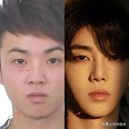 怎么看待华晨宇整容上热搜