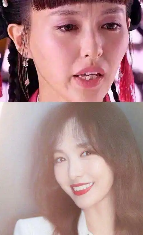 半个娱乐圈的明星都靠它悄悄变成瓜子脸!不是整容