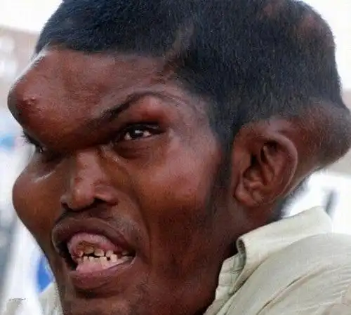 直击全球最丑10大男性,7个非洲,1个印度,竟然全都有老婆!