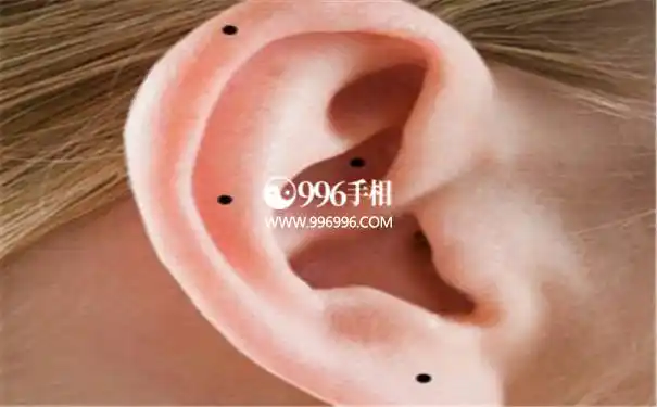 会在耳朵上长痣的女人其实会在耳朵上有痣,是属于一种病害的情况.