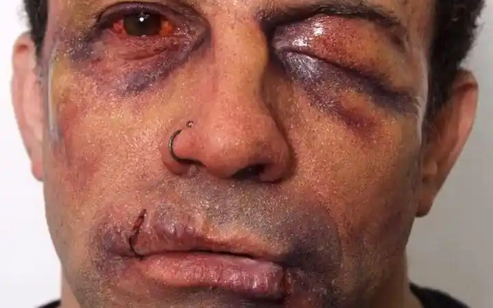 【特效化妆】伤效妆