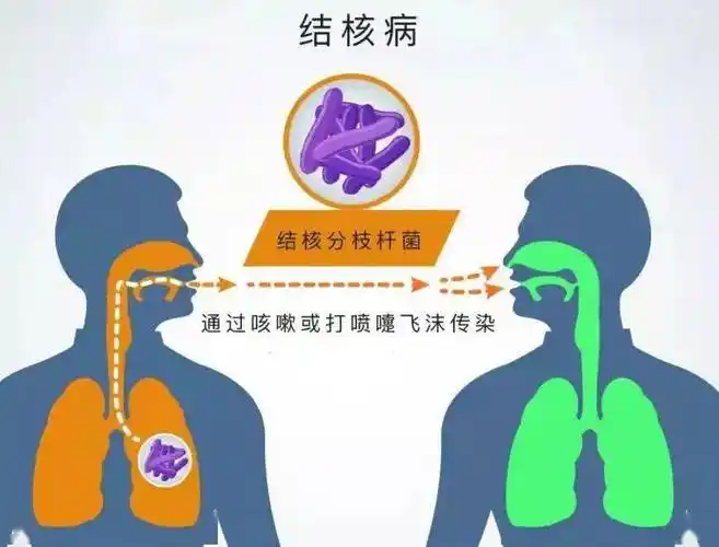 肺结核主要由结核杆菌经空气传播.