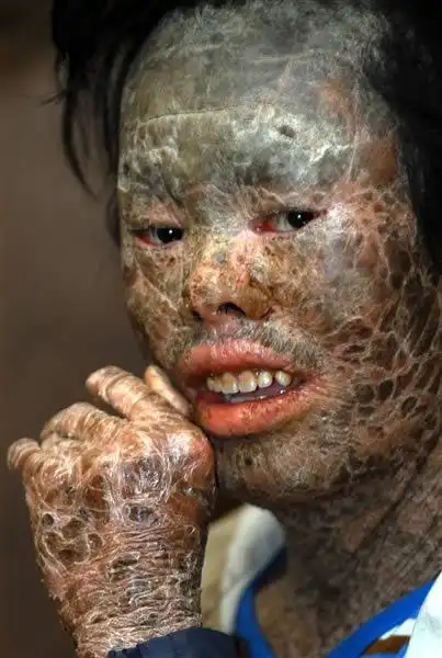 世界恐怖的52种怪病盘点:有些匪夷所思有些细致极恐-昕薇网