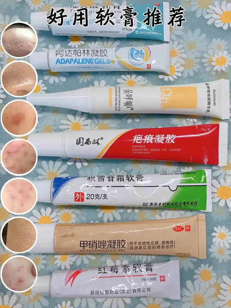 metronidazoee gey 质地清爽 甲硝凝胶 以 - 抖音