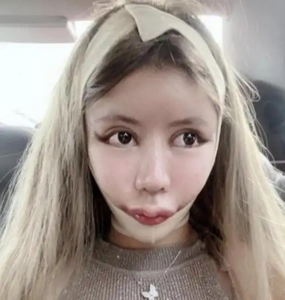 那些沉迷整容的网红,有哪些整失败了?反面教材桃花宝宝,迪丽拉