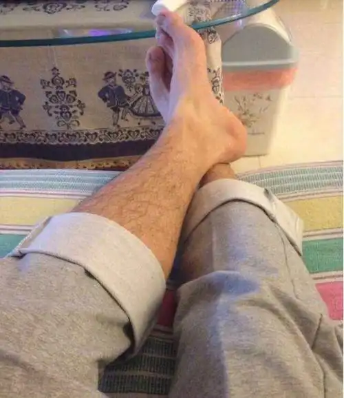 为什么有的男生腿毛浓密,有的却很光滑?护士说出真相很简单