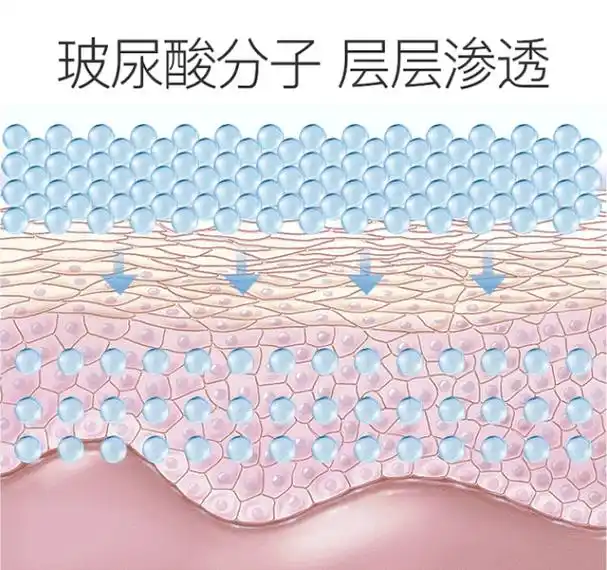 医生科普|玻尿酸到底有什么用?