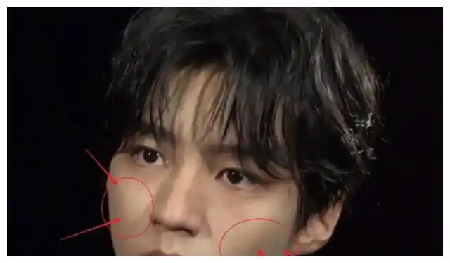 王俊凯无美颜的生图曝光,配上"死亡打光",这颜值是认真的吗?