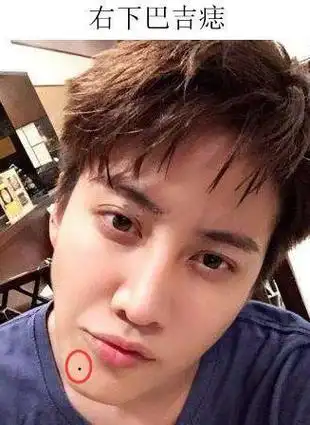 男人的下巴生有吉痣有着哪些寓意你们知道吗