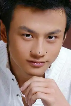 男人长在鼻子上的痣,鼻子在面相12宫中称为"财帛宫",鼻头越丰隆,收入