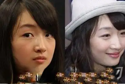 周冬雨照片资料周冬雨割双眼皮照片周冬雨整容前后对比照