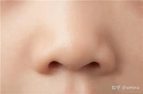 如何通过手术方式改善鼻翼肥大