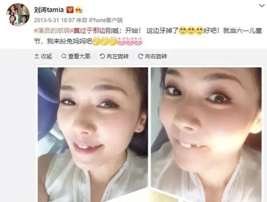 原创女明星假牙大pk谁的嘴巴闭不上谁的嘴里藏着一套房