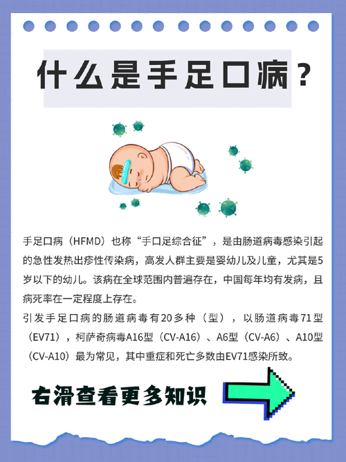 手足口病高发期!出现这些症状别大意!
