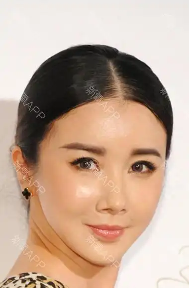 自体脂肪填一切?我看好多女明星都填充了吧!那脸啊_圈子-新氧美容整形