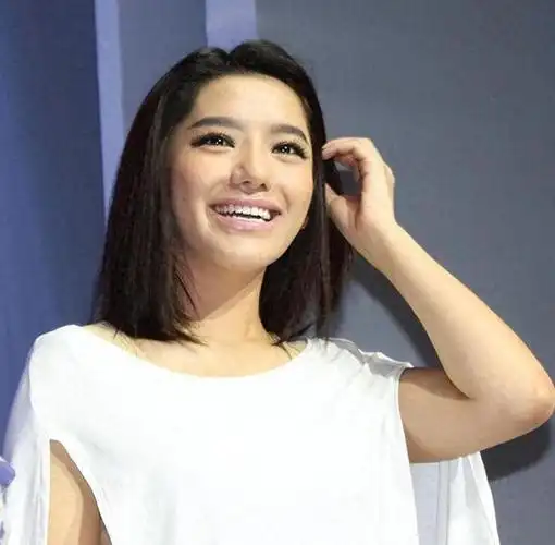 超女冠军江映蓉因整容失败像怪物全身只剩眼珠是自己的