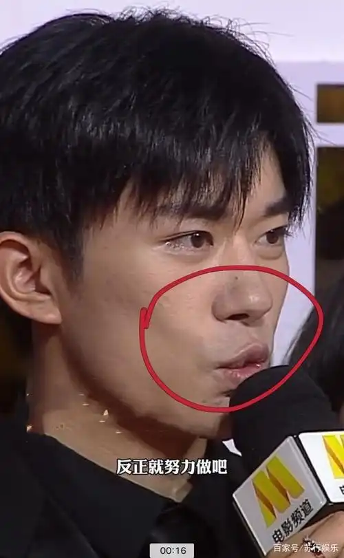 金鸡奖红毯:易烊千玺皮肤"垮掉",离开滤镜痘痘太多