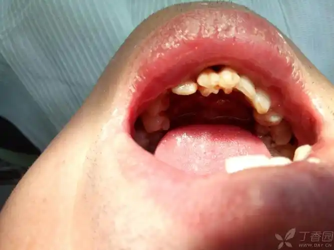 试试他们换一换 2017-02-22 12:44来自 android客户端浏览 : 561回复