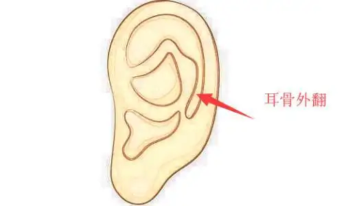 薄情寡义的面相