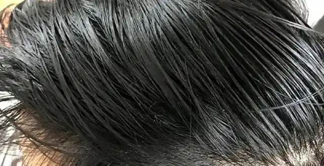 头发爱出油到底是哪里出了问题提醒或是湿气重的缘故