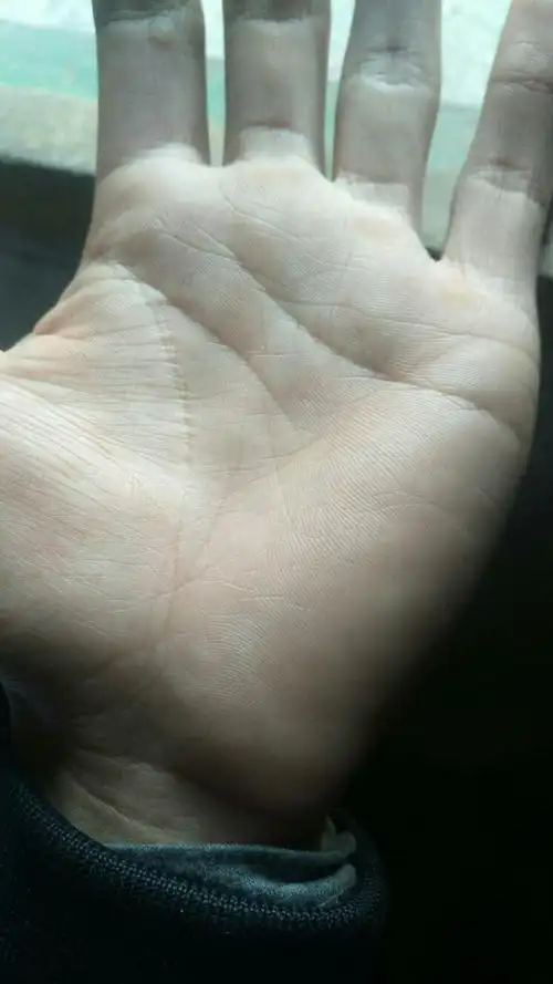 左手生命线有岛纹,还很大打师帮我看看