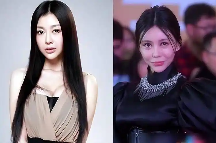 盘点娱乐圈5位整容最成功的女明星,前后判若两人,看着毫无痕迹_面部