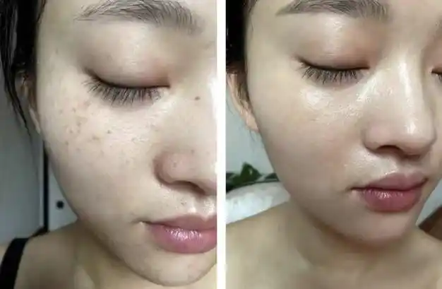 祛斑|美白|眼霜|护肤品|黑眼圈_网易订阅