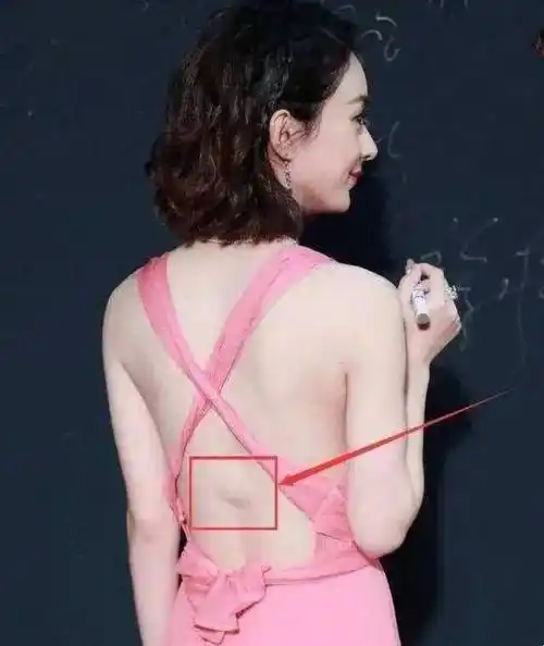 迪丽热巴肚子上有妊娠纹也有说是肥胖纹其实都不对那是伤疤