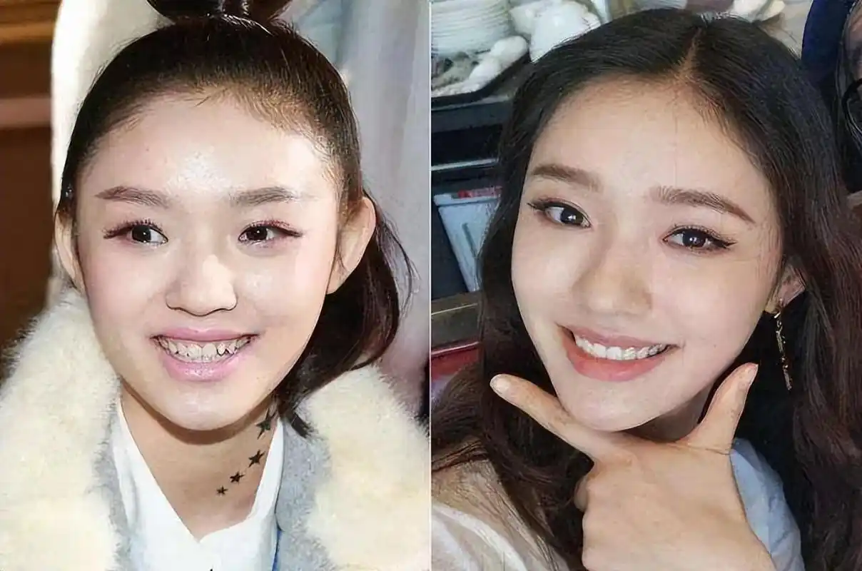 女明星"假牙"大pk,谁的嘴巴闭不上,谁的嘴里藏着一套房?