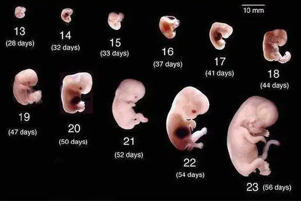 孕8周胚胎发育简报,b超单上有这"四物",表示"坐胎"稳定