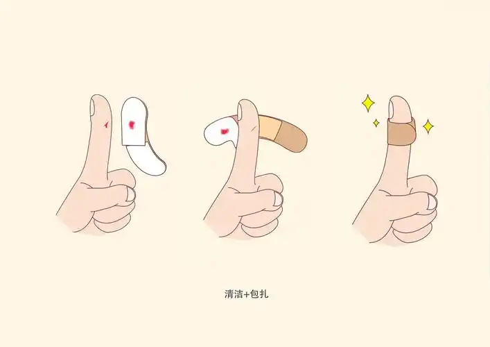 【第78期top榜铜奖】可以清洁伤口的创可贴