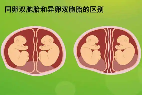 同卵双胞胎和异卵双胞胎的概念首先了解一下两者的概念,就可以初步