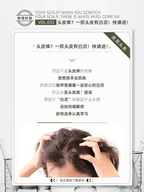 头皮痒6315一抓头皮有白泥!快请进!