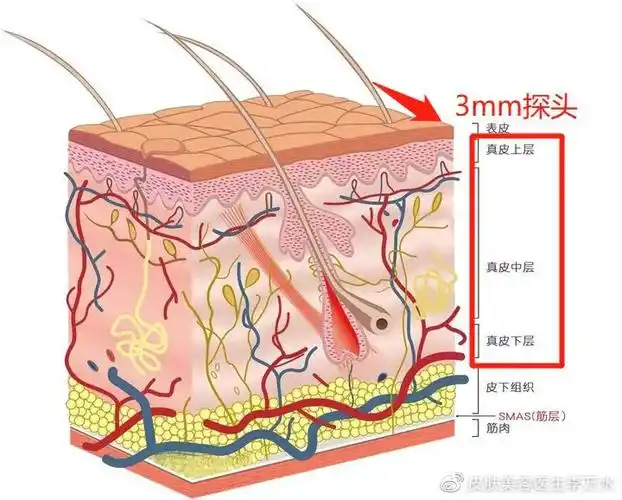 到内,能量集中在真皮深层及皮下脂肪层,可使治疗区域皮肤全层加热收紧