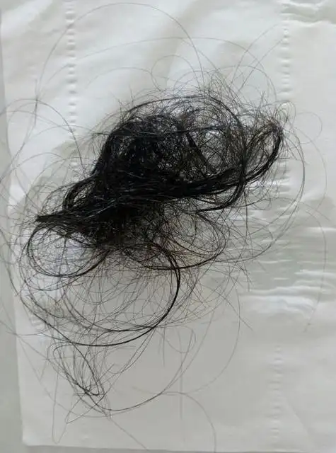头发平时掉的特别多 一抓掉一把 这是怎么回事啊