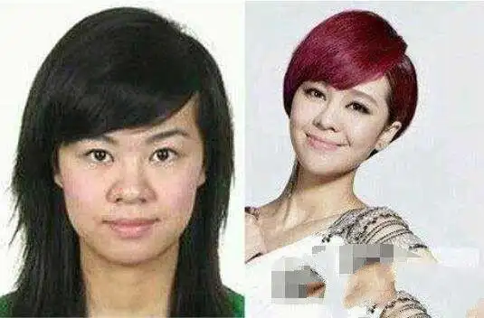 郁可唯整容前后照片对比鼻子变形遭网友批整残