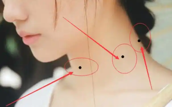 痣相解析脖子长痣是不是一件好事呢