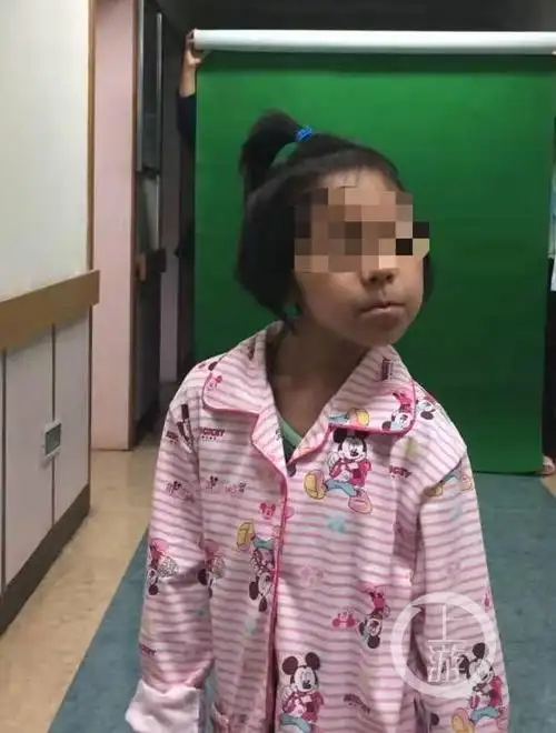 脖子一扭就无法复位 家里出现"歪头宝宝"千万要注意