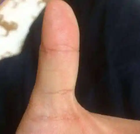 由于左手本来即是主张理性的手掌,假设你的左手大拇指上有这样的一个