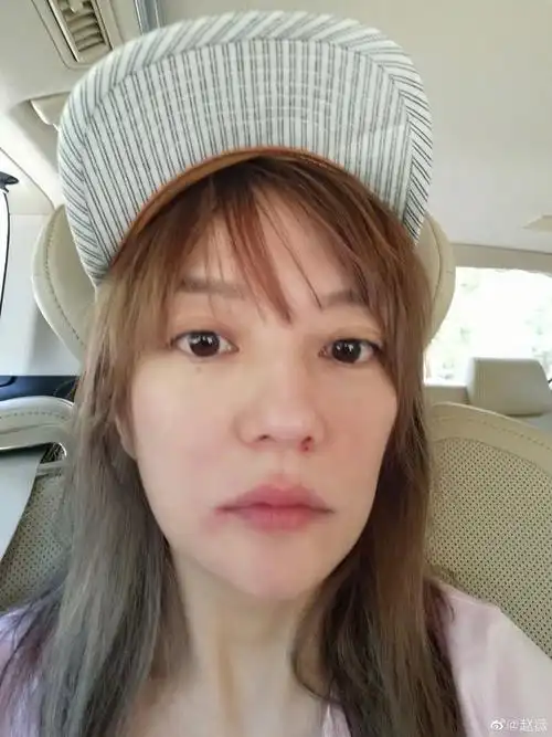 赵薇满脸长痘模样惨,照样怼脸拍晒素颜