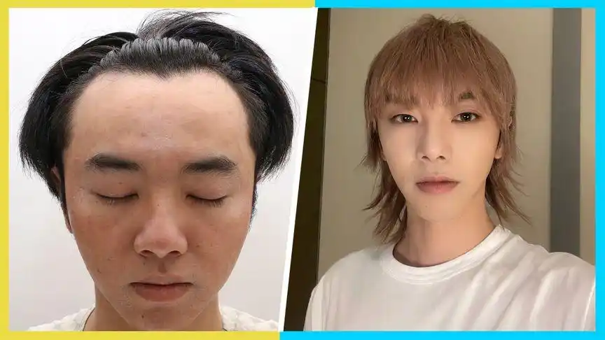 华晨宇被爆出轨植发多次用钱来摆平此事张碧晨竟然是小三