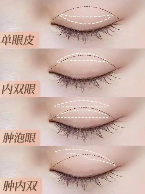 不同眼型的双眼皮贴教程