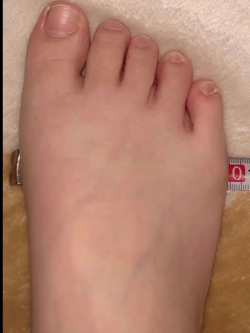 36码近10cm宽的脚还有救吗 买鞋只能买37(挤脚)38(不挤脚但是大得能塞