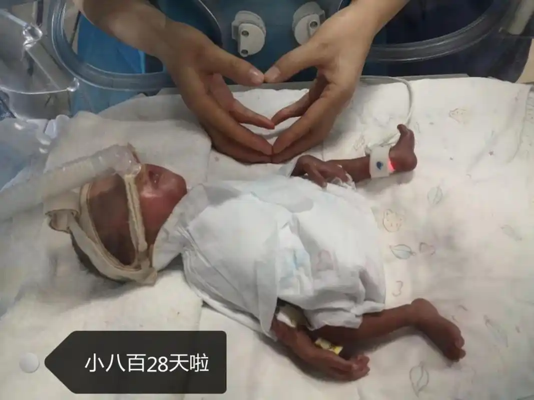 妈妈怀孕6个月产下男婴!10张照片,张张让人落泪.